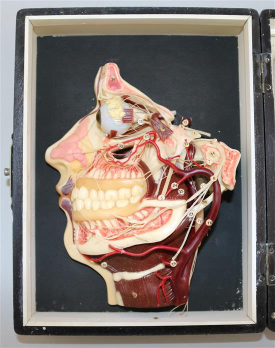 A Mittelwerk wax medical model of the internal workings of a human head, 9.5in.